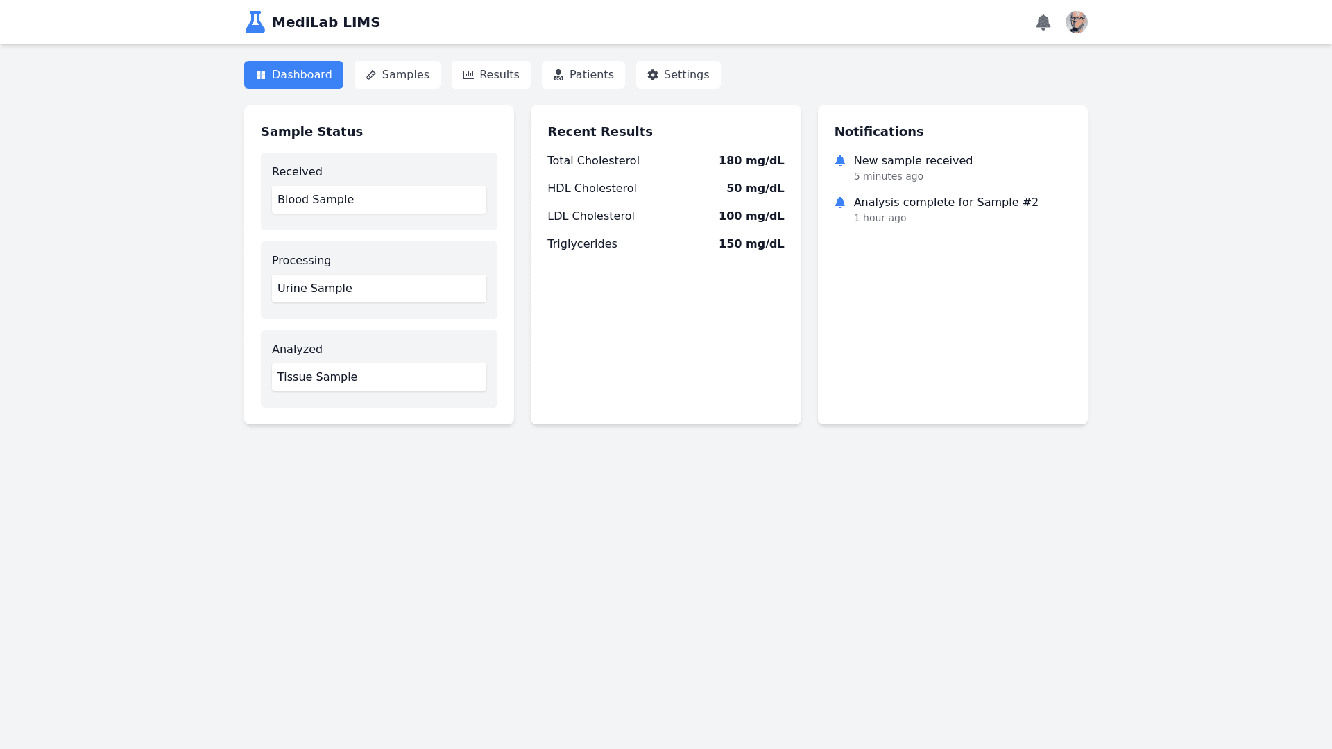 Component Preview